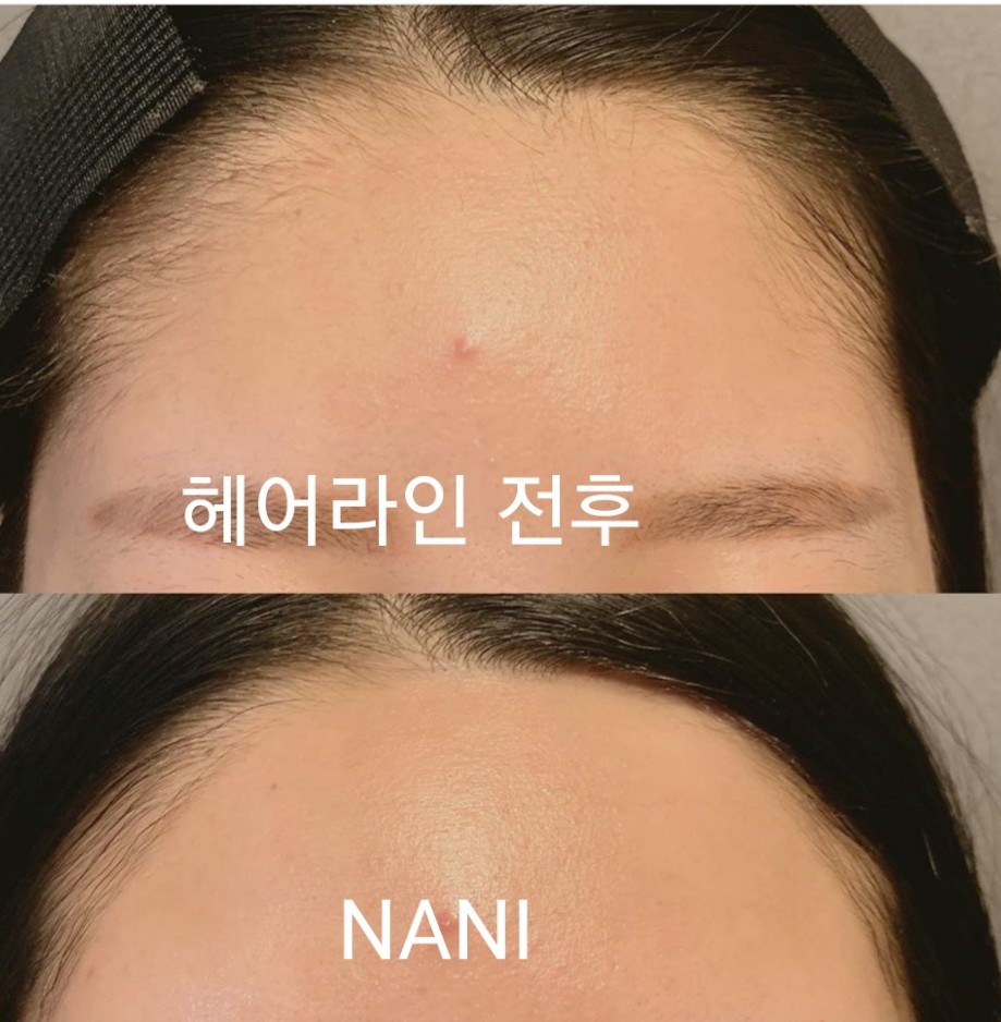 포트폴리오